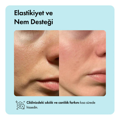 Zero Pore™ Temizleme Barı ys-zeropore-cod-tk