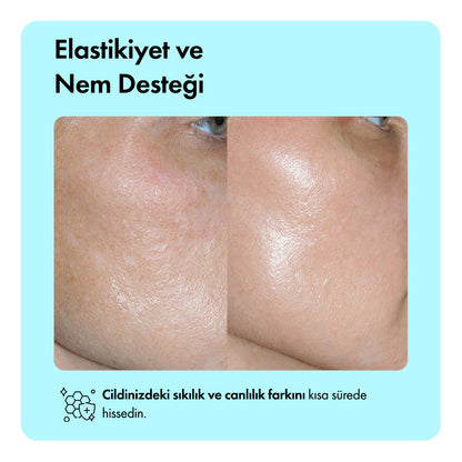 Hediye Zero Pore™ Gözenek Sıkılaştırıcı Serum
