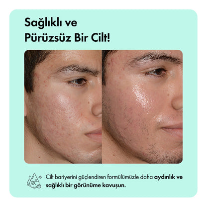 Hediye Anti-Acne Serumu