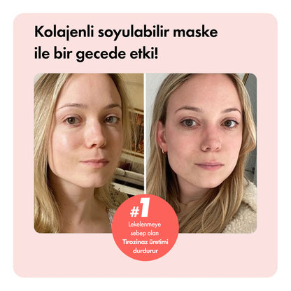 Collagen Night™ Soyulabilir Kolajen Maske ys-collagennight