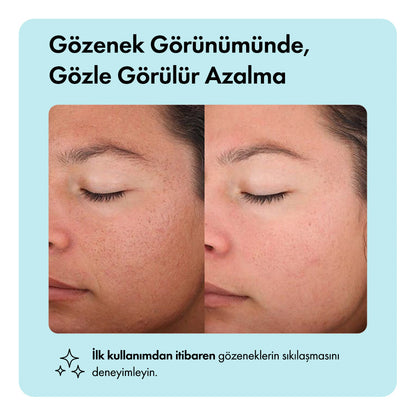 Zero Pore™ Temizleme Barı ys-zeropore-cod