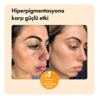 Kojiso™ Temizleme Barı ys-kojiso