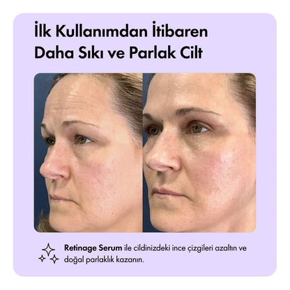 Retinage™ Serum