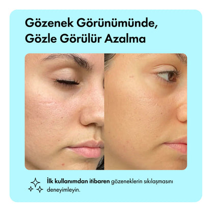 Hediye Zero Pore™ Gözenek Sıkılaştırıcı Serum