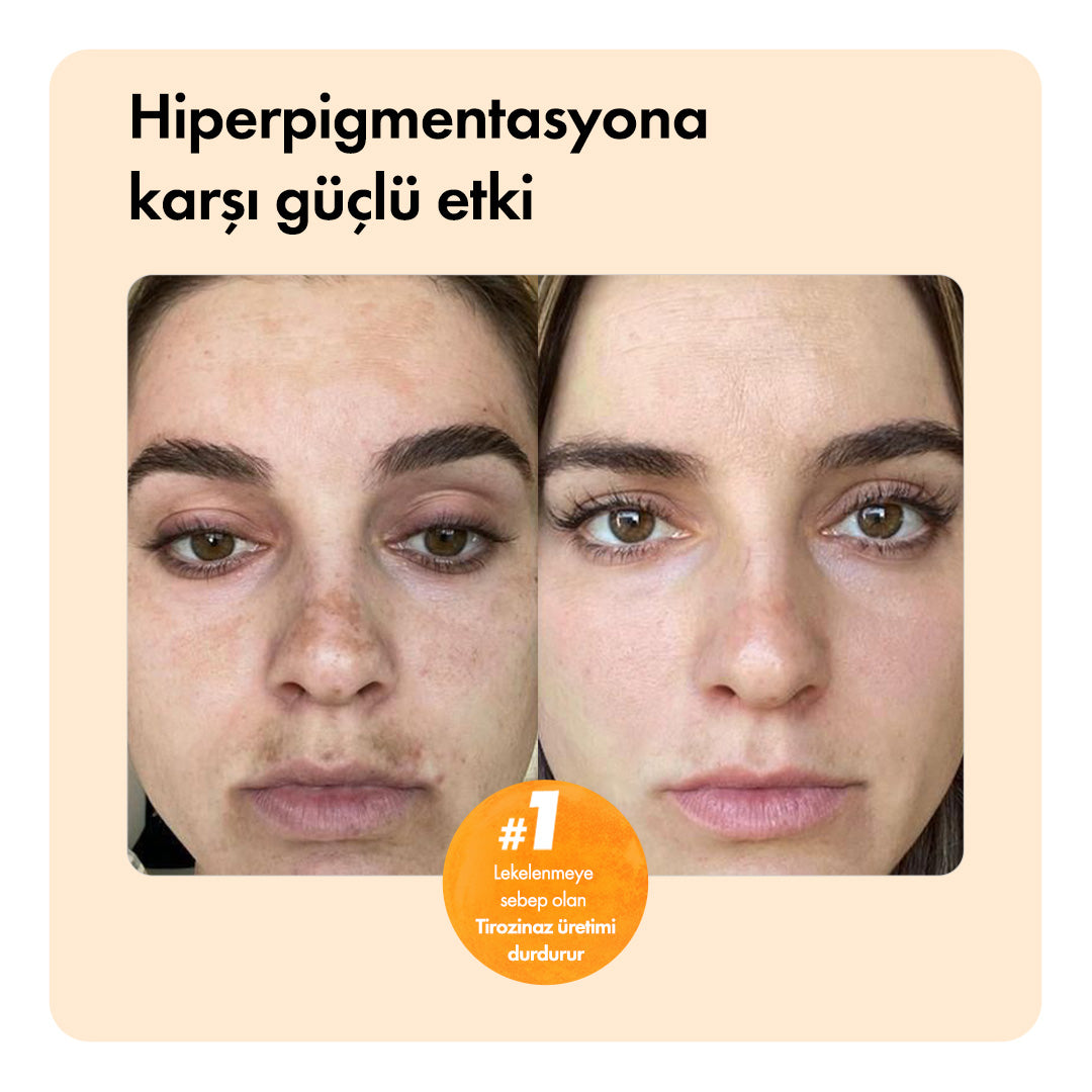 Kojiso™ Temizleme Barı ys-kojiso