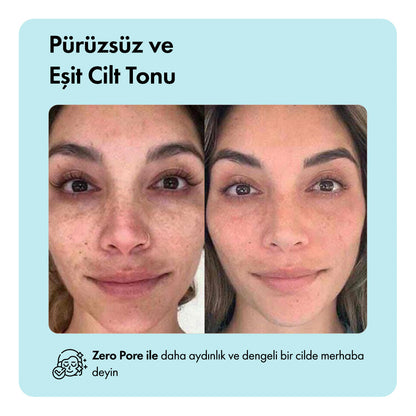 Zero Pore™ Temizleme Barı ys-zeropore-cod