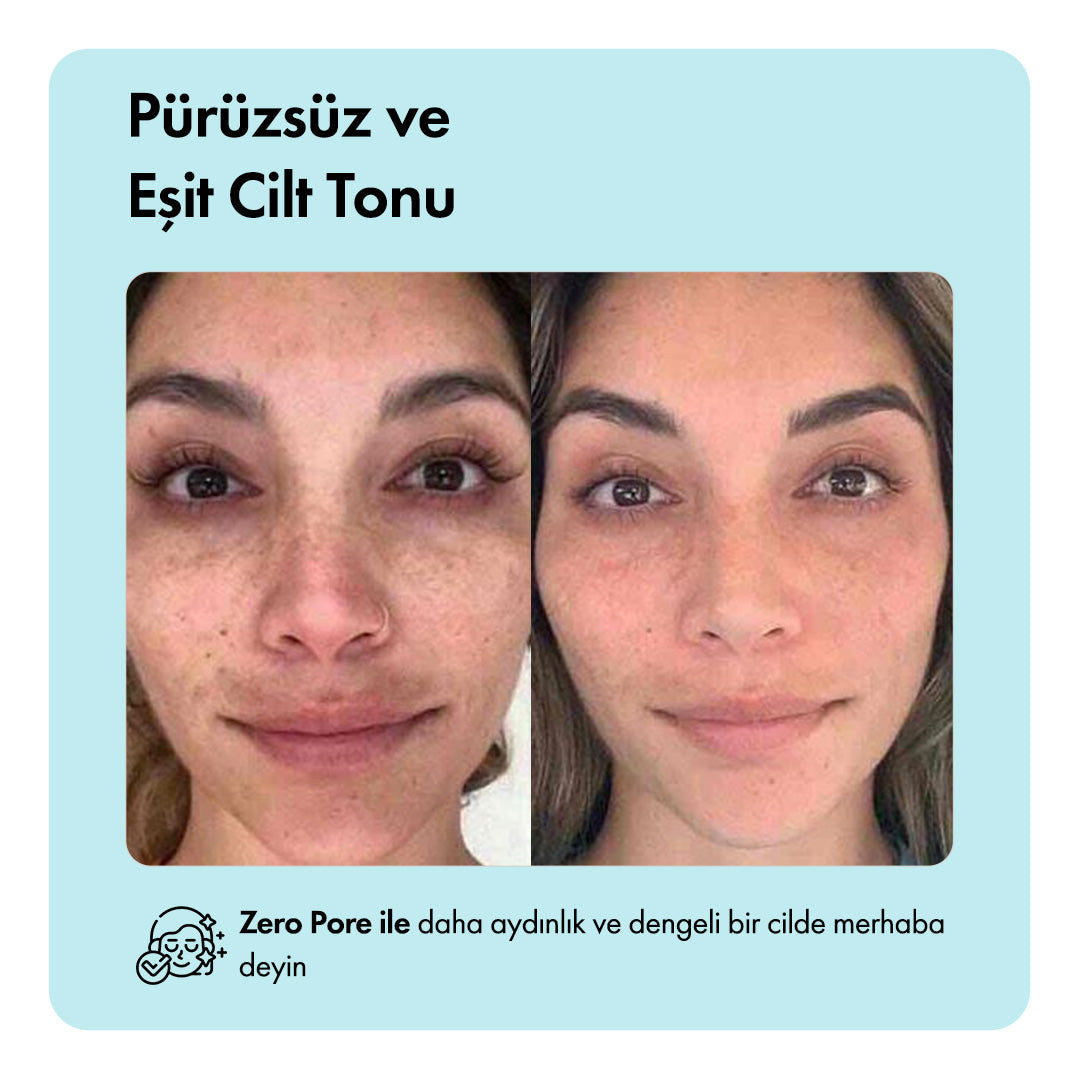Zero Pore™ Temizleme Barı ys-zeropore-cod-tk