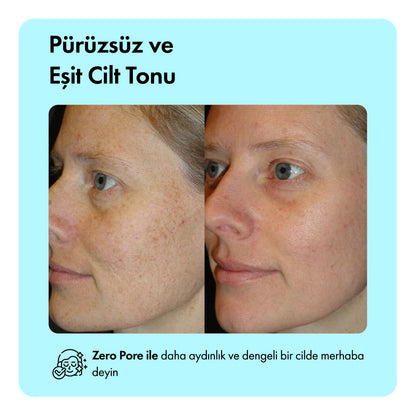 Hediye Zero Pore™ Gözenek Sıkılaştırıcı Serum