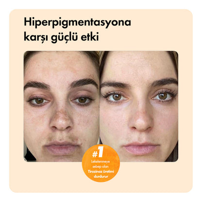 Kojiso™ Temizleme Barı ys-kojiso-cod